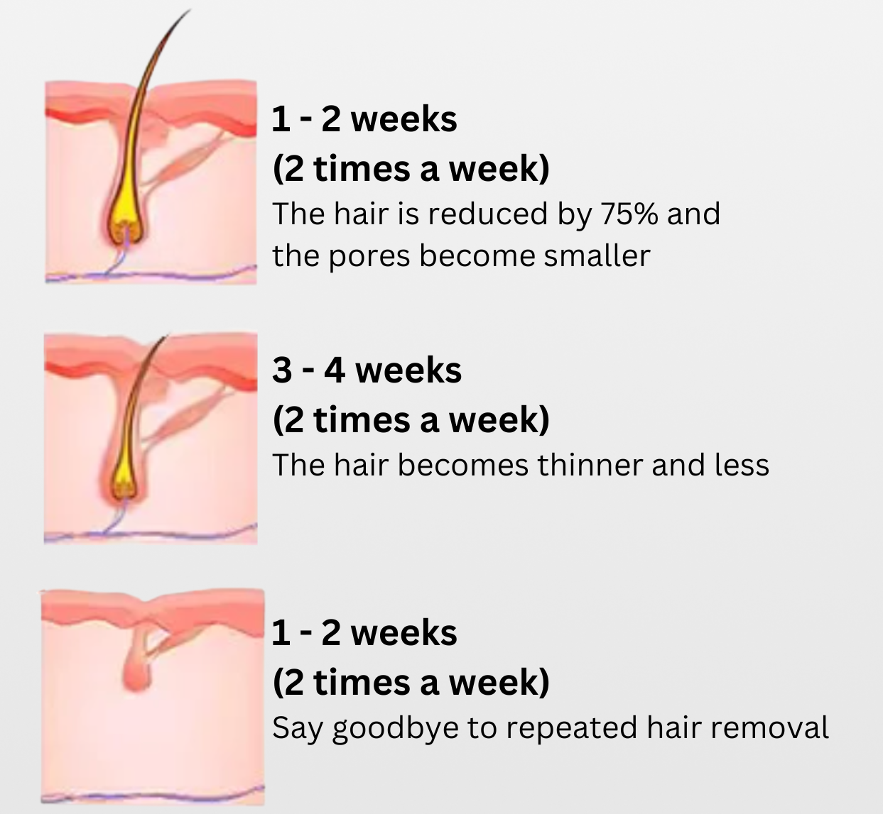 SmoothSkin Painless Hair Remover