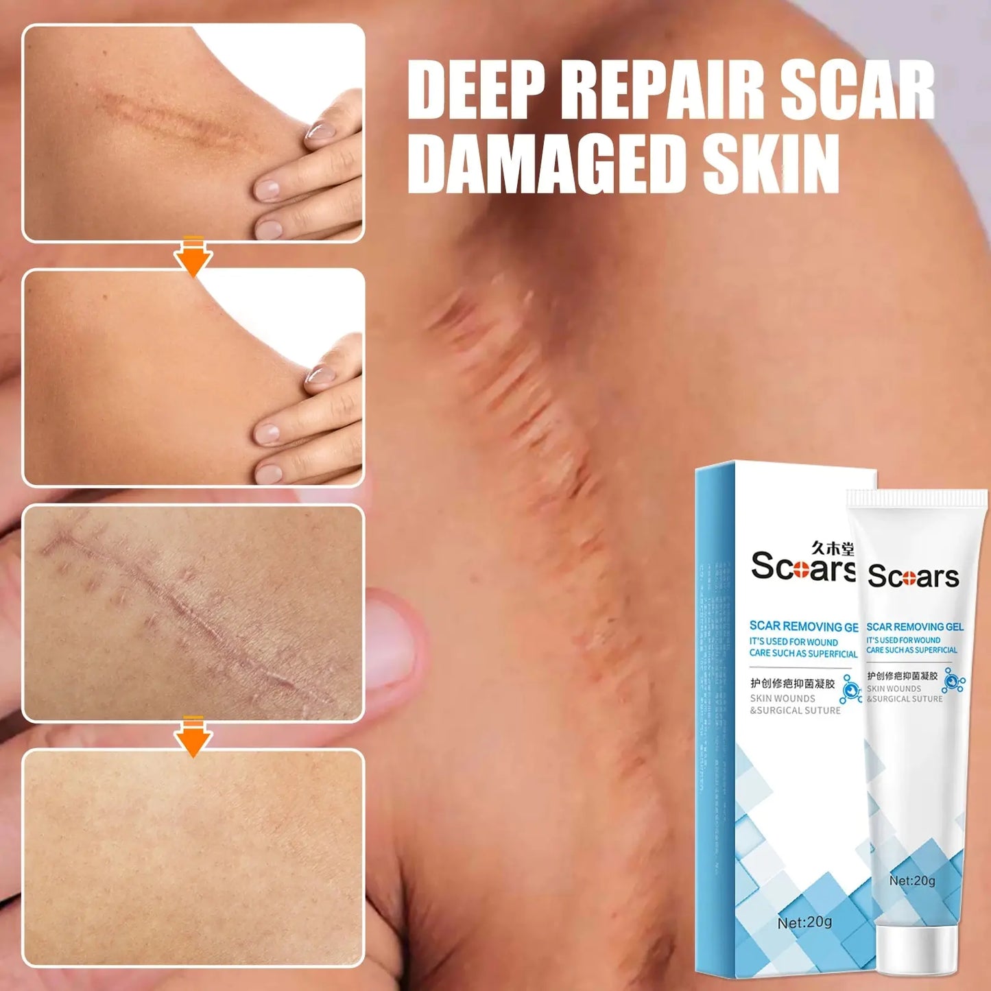 Skin Scar Repair Cream