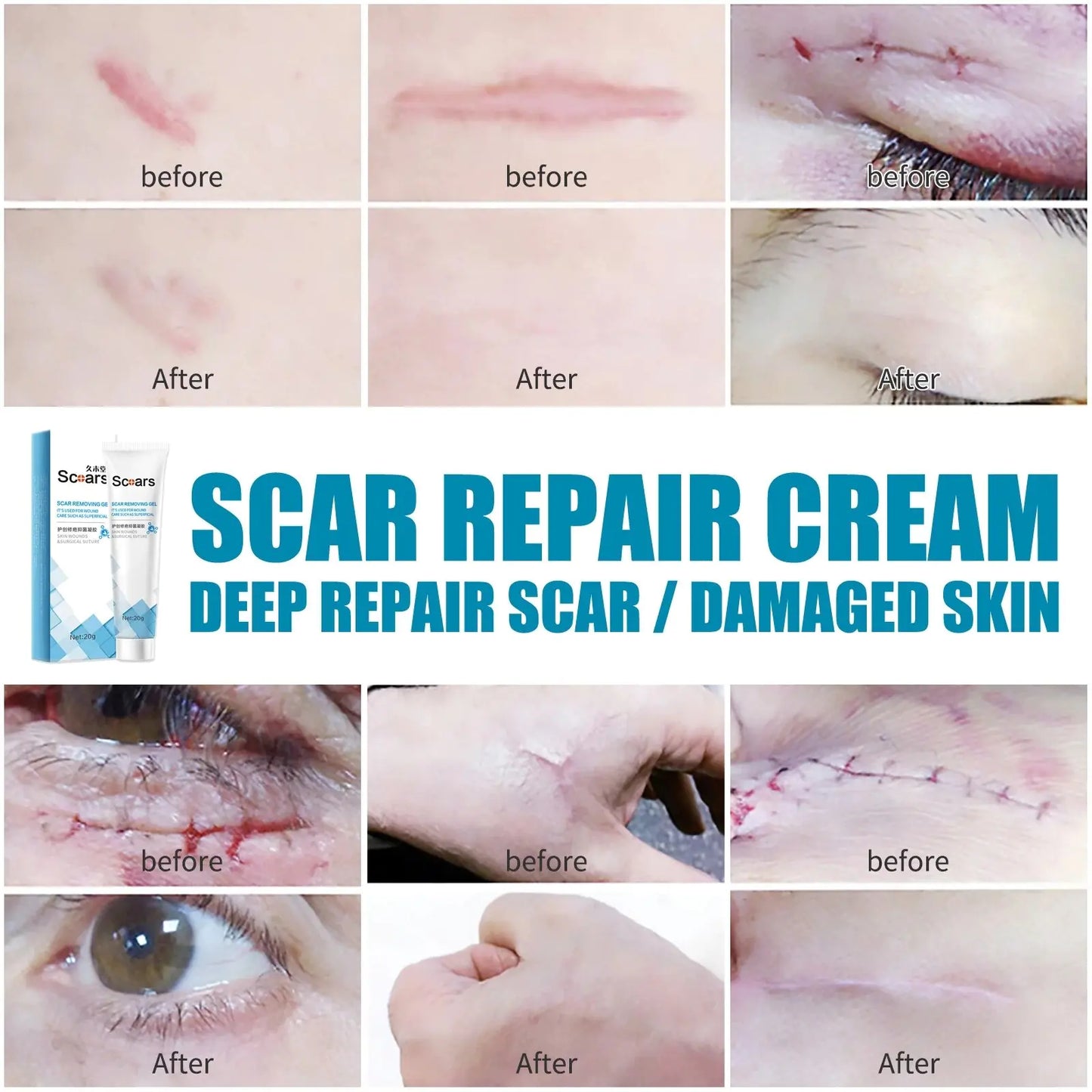 Skin Scar Repair Cream