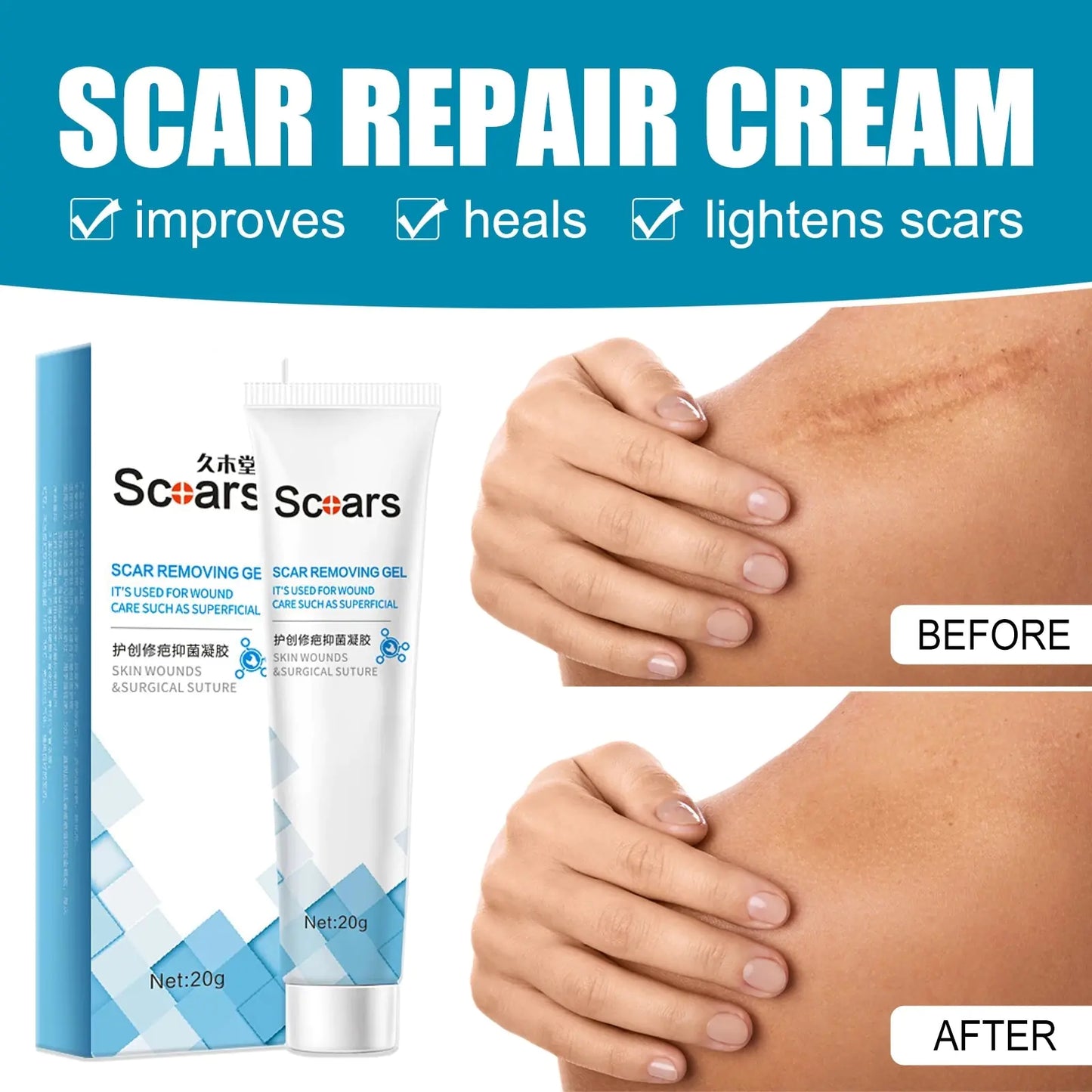 Skin Scar Repair Cream